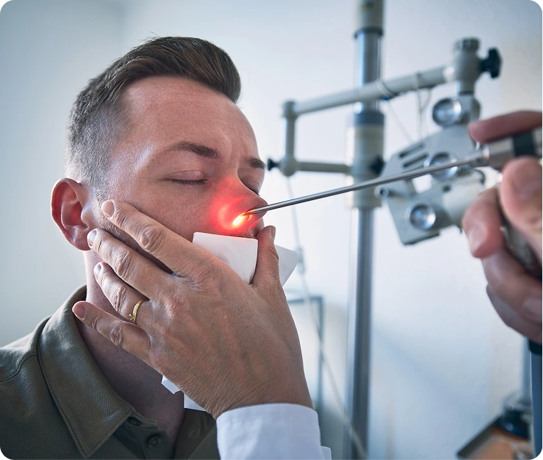 Nasal endoscopy with illuminated scope